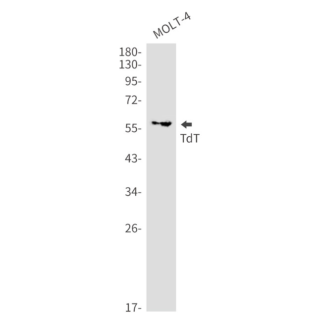 TdT Antibody in Western Blot (WB)