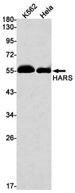 HARS Antibody in Western Blot (WB)
