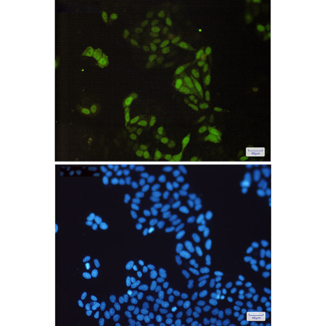 Cyclin A2 Antibody in Immunocytochemistry (ICC/IF)