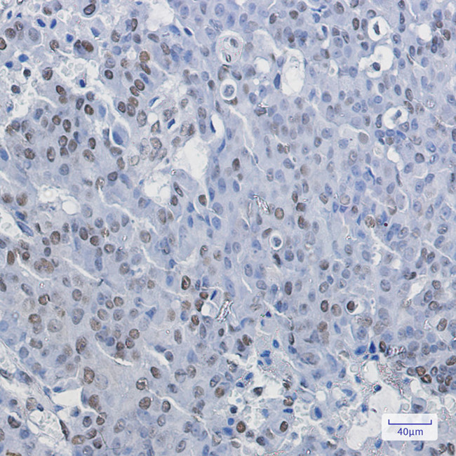RDBP Antibody in Immunohistochemistry (Paraffin) (IHC (P))