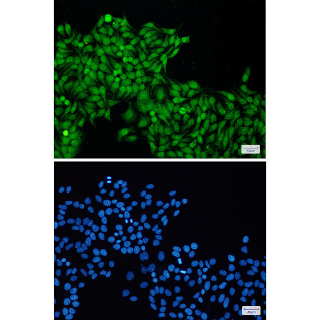 ROC1 Antibody in Immunocytochemistry (ICC/IF)