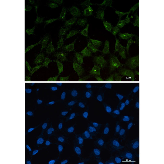 PUMA alpha Antibody in Immunocytochemistry (ICC/IF)