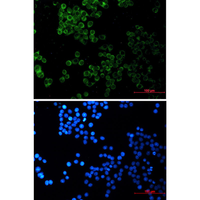 SESN2 Antibody in Immunocytochemistry (ICC/IF)