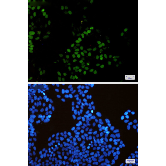 KIFC1 Antibody in Immunocytochemistry (ICC/IF)