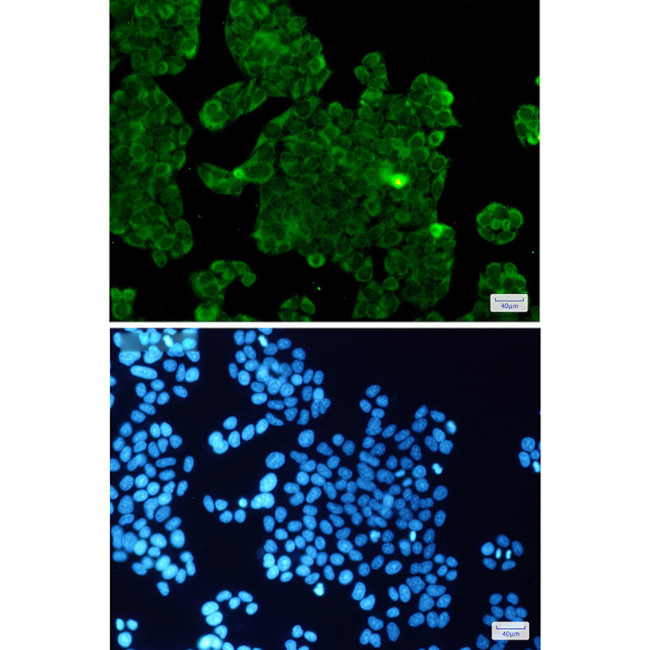 PP1 beta Antibody in Immunocytochemistry (ICC/IF)