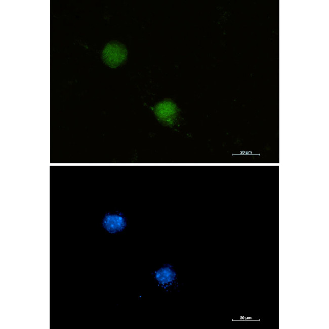 FUBP1 Antibody in Immunocytochemistry (ICC/IF)