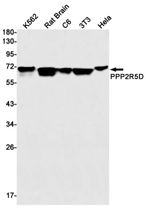 PPP2R5D Antibody in Western Blot (WB)