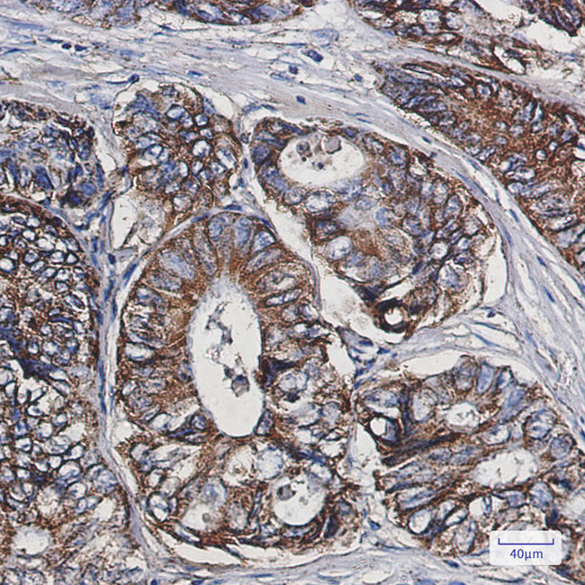 HSPE1 Antibody in Immunohistochemistry (Paraffin) (IHC (P))