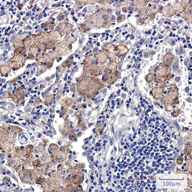SMN1 Antibody in Immunohistochemistry (Paraffin) (IHC (P))