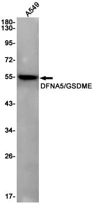 DFNA5 Antibody in Western Blot (WB)