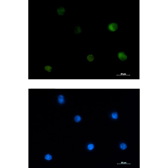 PKC beta Antibody in Immunocytochemistry (ICC/IF)