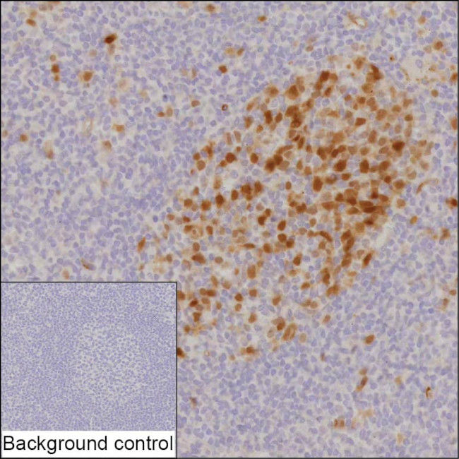 Securin Antibody in Immunohistochemistry (Paraffin) (IHC (P))