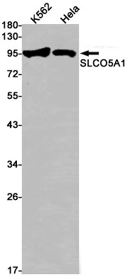 SLCO5A1 Antibody in Western Blot (WB)