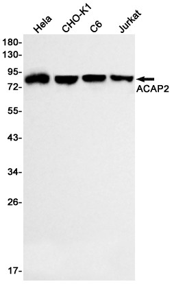 ACAP2 Antibody in Western Blot (WB)