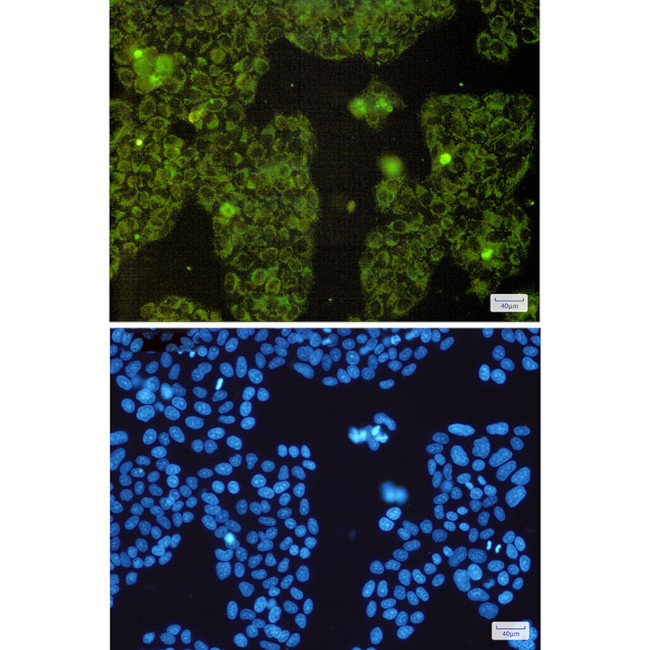 MTCO2 Antibody in Immunocytochemistry (ICC/IF)
