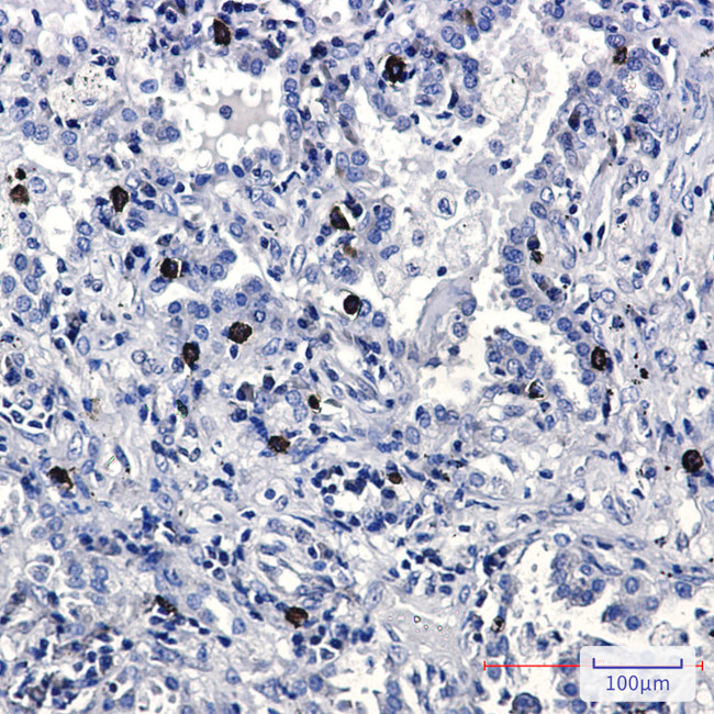 FLI1 Antibody in Immunohistochemistry (Paraffin) (IHC (P))
