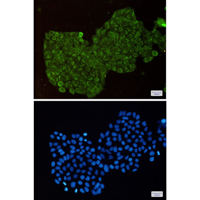 DPYD Antibody in Immunocytochemistry (ICC/IF)