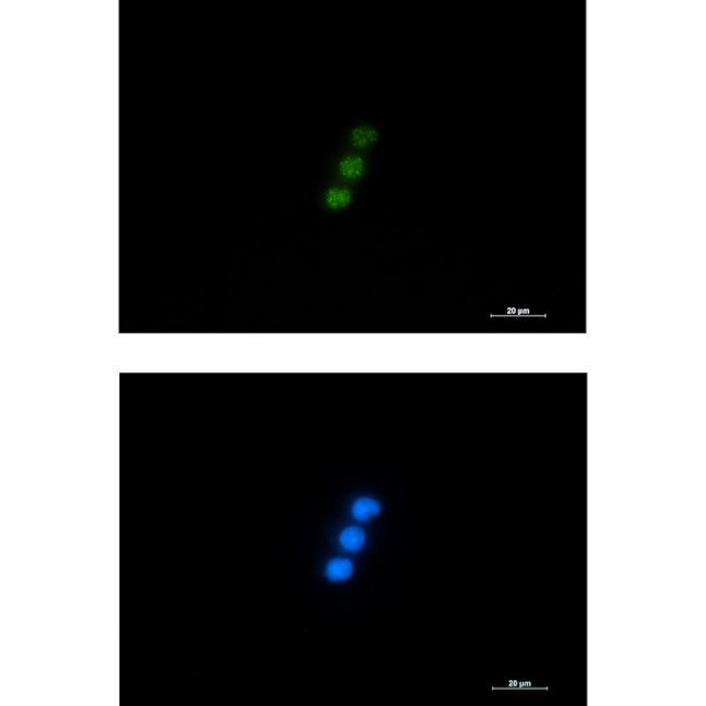 TAP Antibody in Immunocytochemistry (ICC/IF)