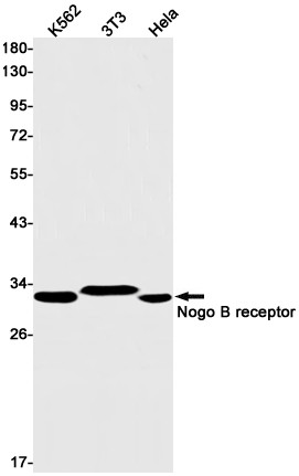 NUS1 Antibody in Western Blot (WB)