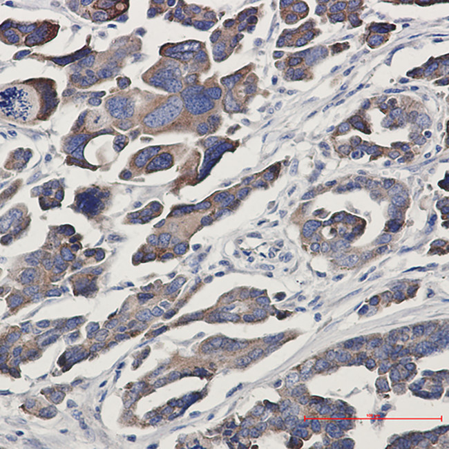 GFPT1 Antibody in Immunohistochemistry (Paraffin) (IHC (P))