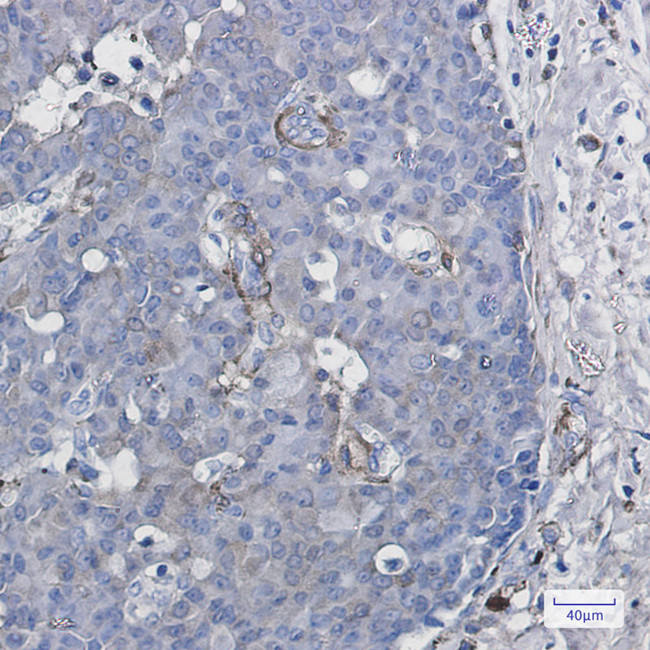 CYP1B1 Antibody in Immunohistochemistry (Paraffin) (IHC (P))