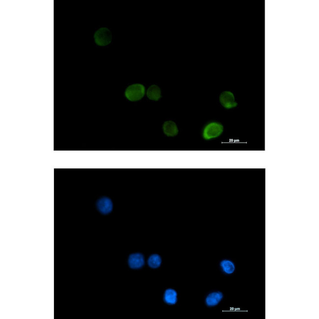 MTHFR Antibody in Immunocytochemistry (ICC/IF)