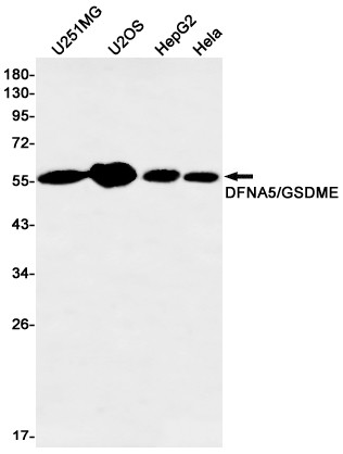 DFNA5 Antibody in Western Blot (WB)