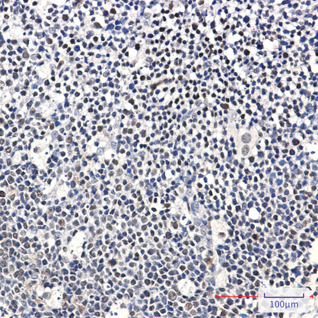 IKAROS Antibody in Immunohistochemistry (Paraffin) (IHC (P))