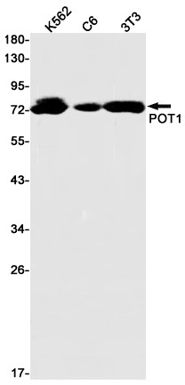 POT1 Antibody in Western Blot (WB)