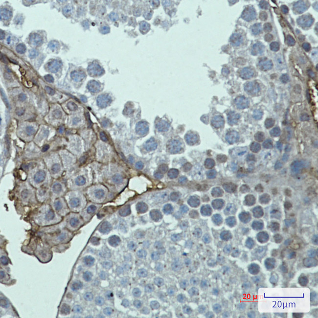 mGluR2 Antibody in Immunohistochemistry (Paraffin) (IHC (P))