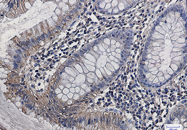 GOT2 Antibody in Immunohistochemistry (Paraffin) (IHC (P))