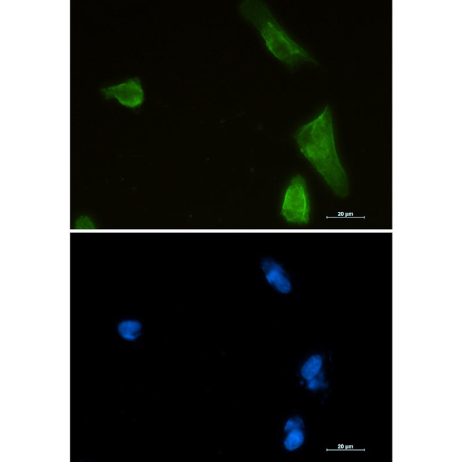 IKK beta Antibody in Immunocytochemistry (ICC/IF)
