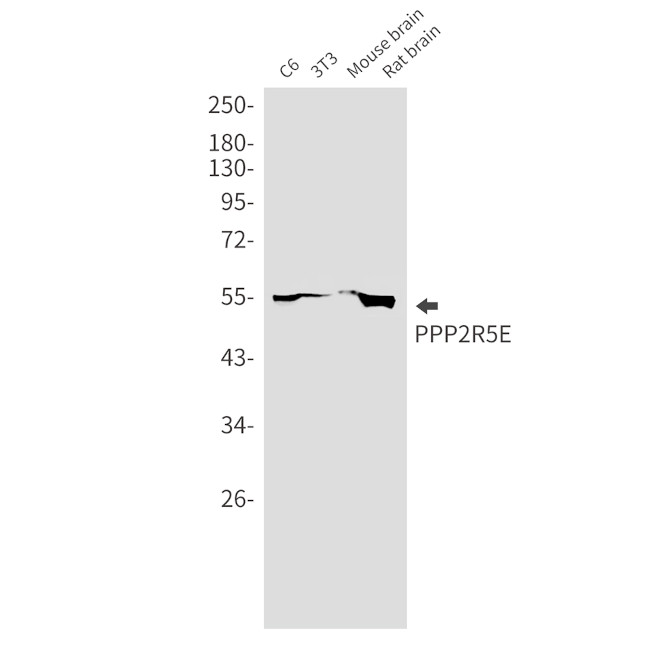 PPP2R5E Antibody in Western Blot (WB)