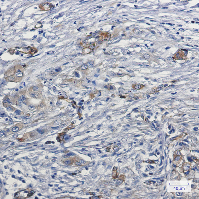 MYO1B Antibody in Immunohistochemistry (Paraffin) (IHC (P))
