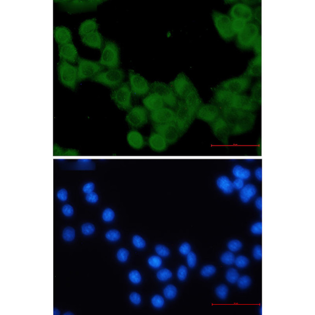 Kinesin 5B Antibody in Immunocytochemistry (ICC/IF)