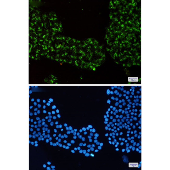 RAB7 Antibody in Immunocytochemistry (ICC/IF)