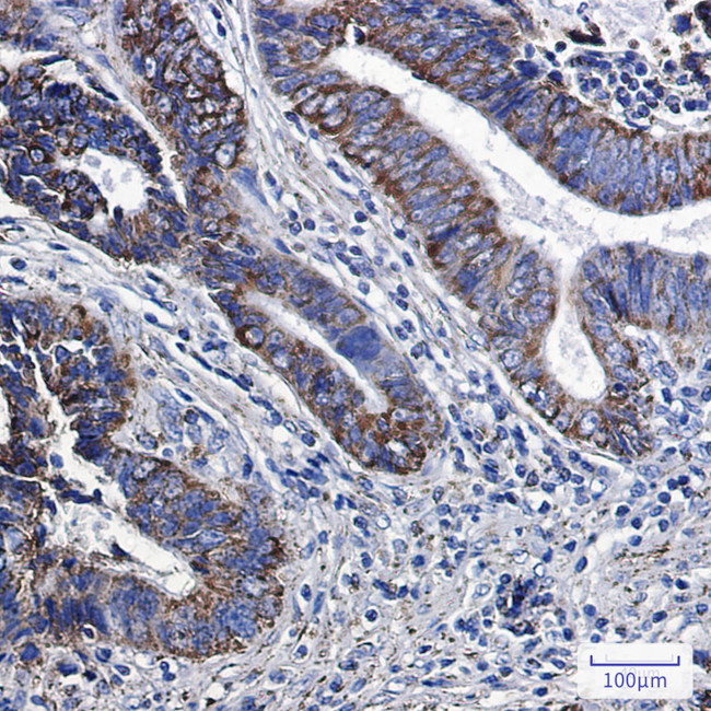 MGST3 Antibody in Immunohistochemistry (Paraffin) (IHC (P))