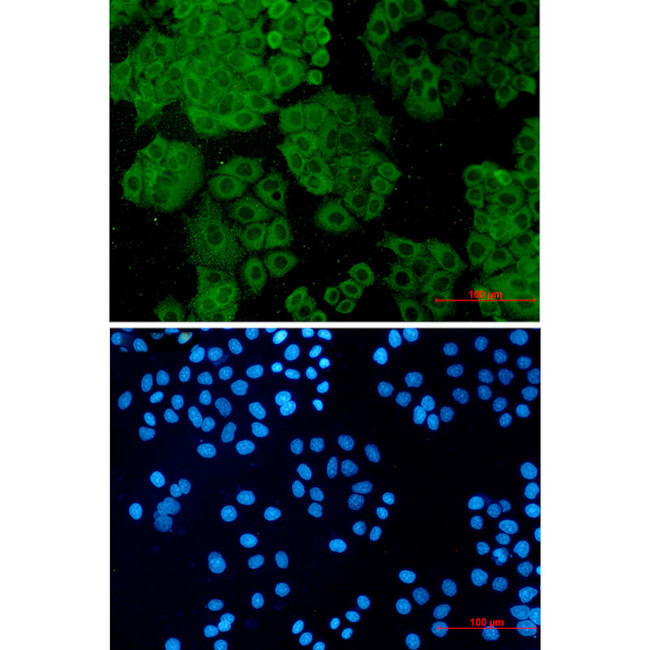 Fumarase Antibody in Immunocytochemistry (ICC/IF)