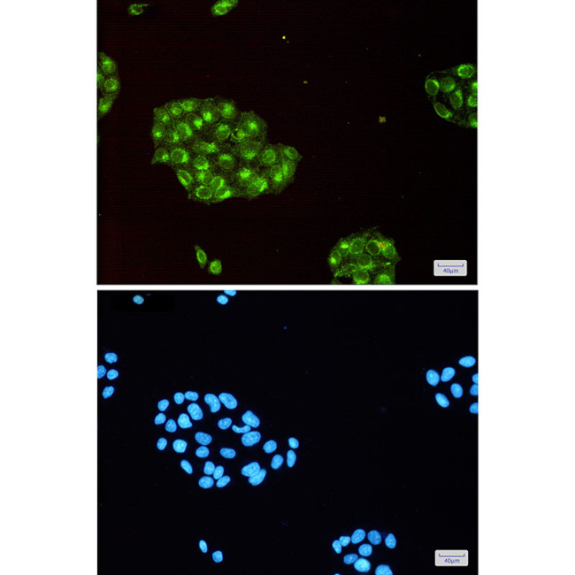 IFITM3 Antibody in Immunocytochemistry (ICC/IF)