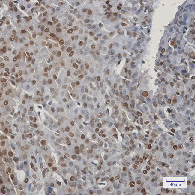 CIRBP Antibody in Immunohistochemistry (Paraffin) (IHC (P))
