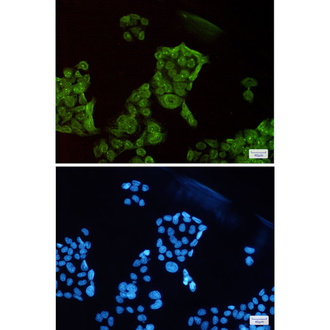 SET Antibody in Immunocytochemistry (ICC/IF)