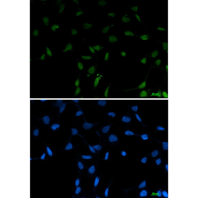 SFPQ Antibody in Immunocytochemistry (ICC/IF)