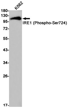 Phospho-IRE1 alpha (Ser724) Antibody in Western Blot (WB)