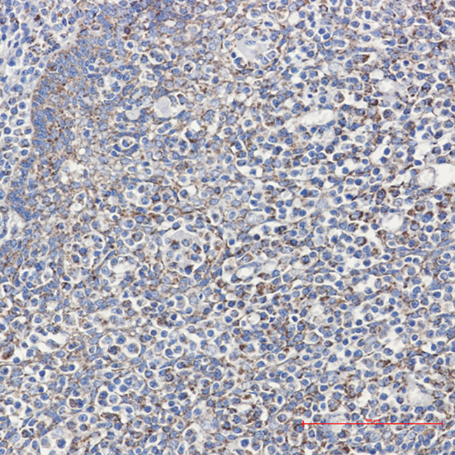 Cyclophilin F Antibody in Immunohistochemistry (Paraffin) (IHC (P))