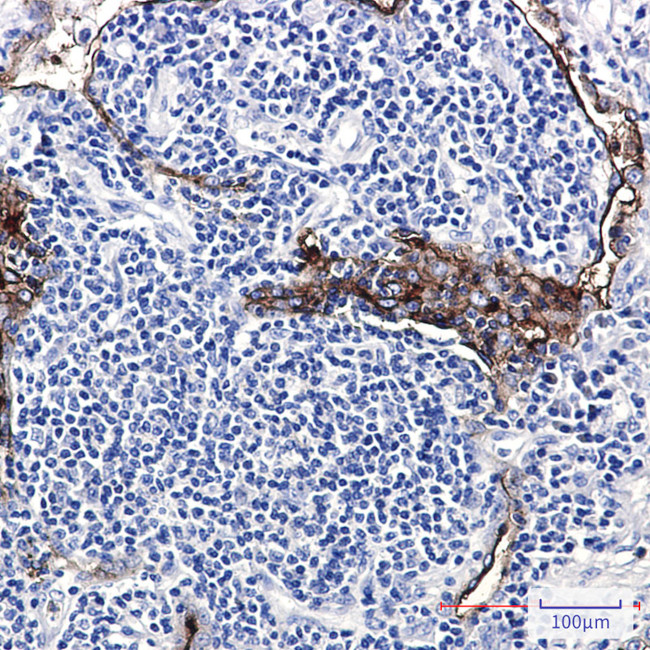 Folate Receptor alpha Antibody in Immunohistochemistry (Paraffin) (IHC (P))
