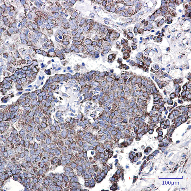 NDUFC2 Antibody in Immunohistochemistry (Paraffin) (IHC (P))