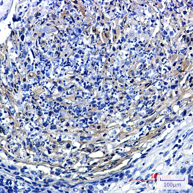 PRMT3 Antibody in Immunohistochemistry (Paraffin) (IHC (P))