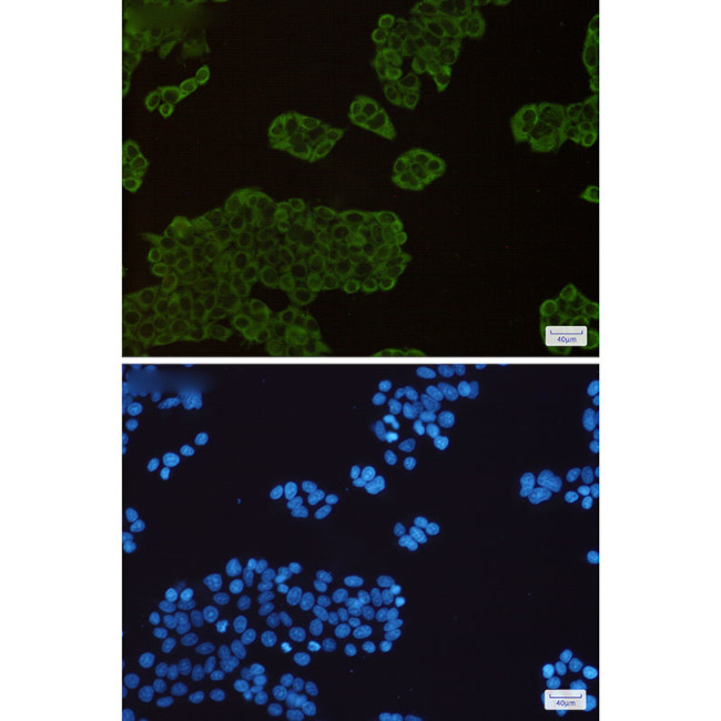 HSP90 Antibody in Immunocytochemistry (ICC/IF)