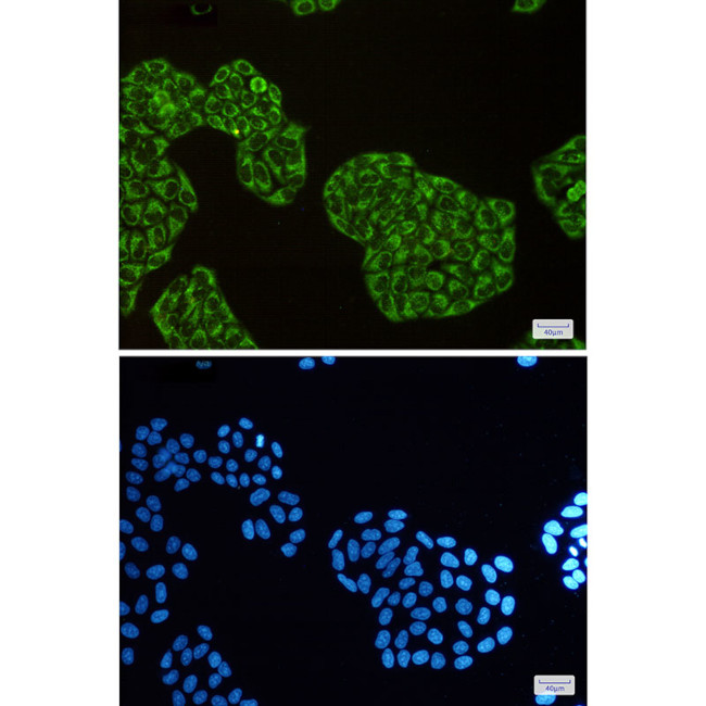 DISC1 Antibody in Immunocytochemistry (ICC/IF)