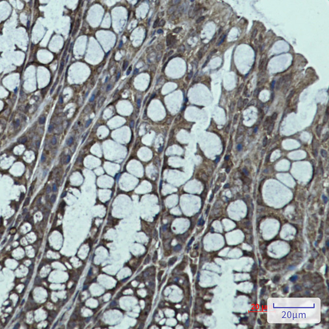 IGF2BP1 Antibody in Immunohistochemistry (Paraffin) (IHC (P))